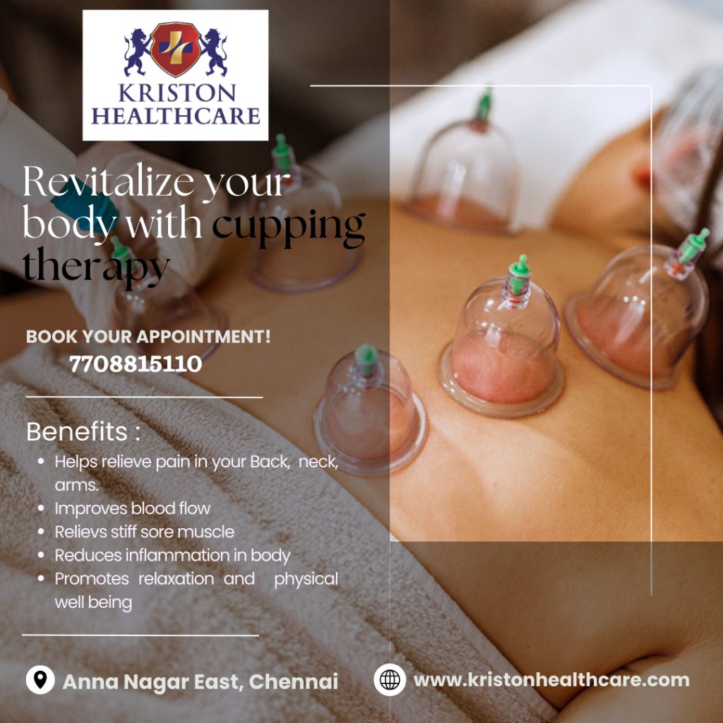 Cupping Therapy