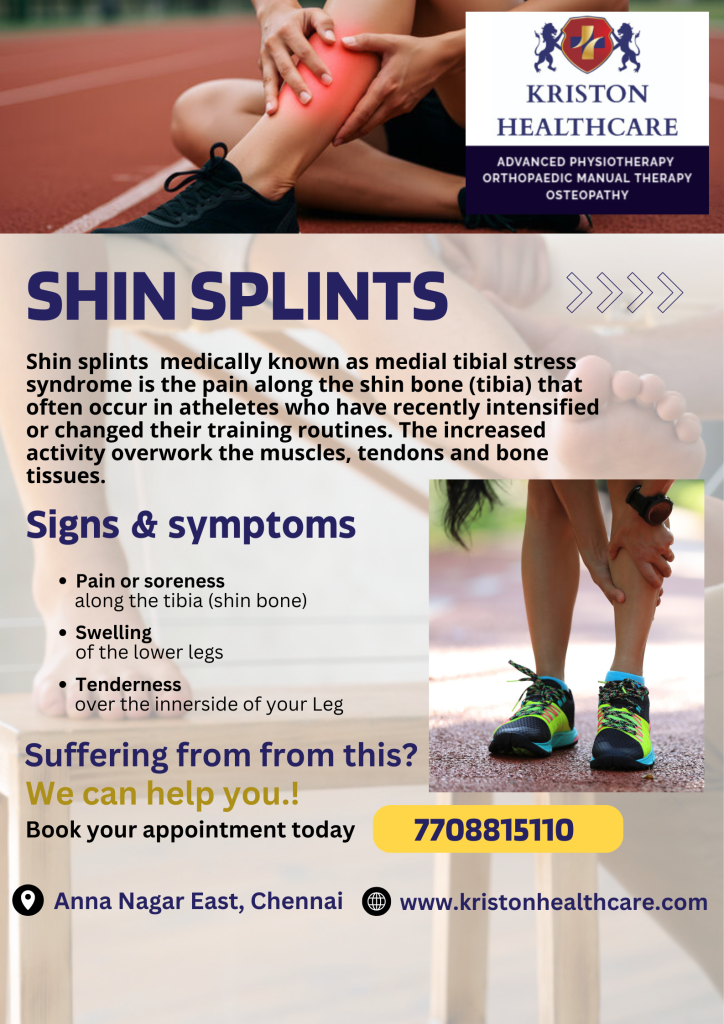 Shin Splints
