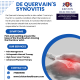 De Quervain’s tenosynovitis